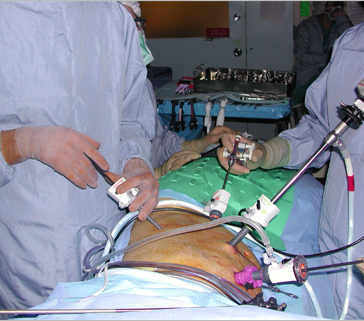 Cadaveric Donor Nephrectomy: Isolated Renal Procurement
